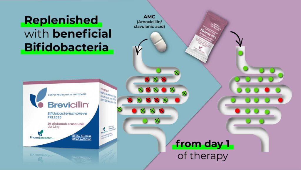 Brevicillin®: birth of a new probiotic tool to serve as add-on treatment to Amoxicillin/Clavulanic acid